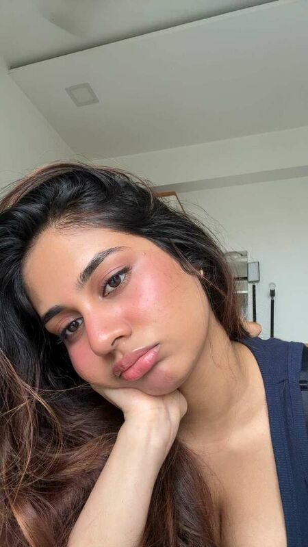 Attachment