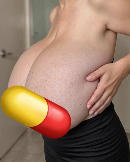 Attachment